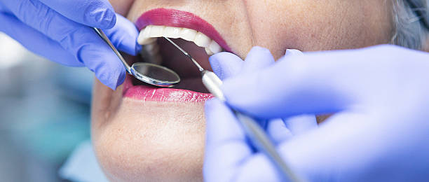 Best Emergency Tooth Extraction in Governors Clu, NC